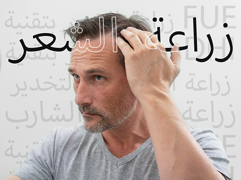 زراعة الشعر