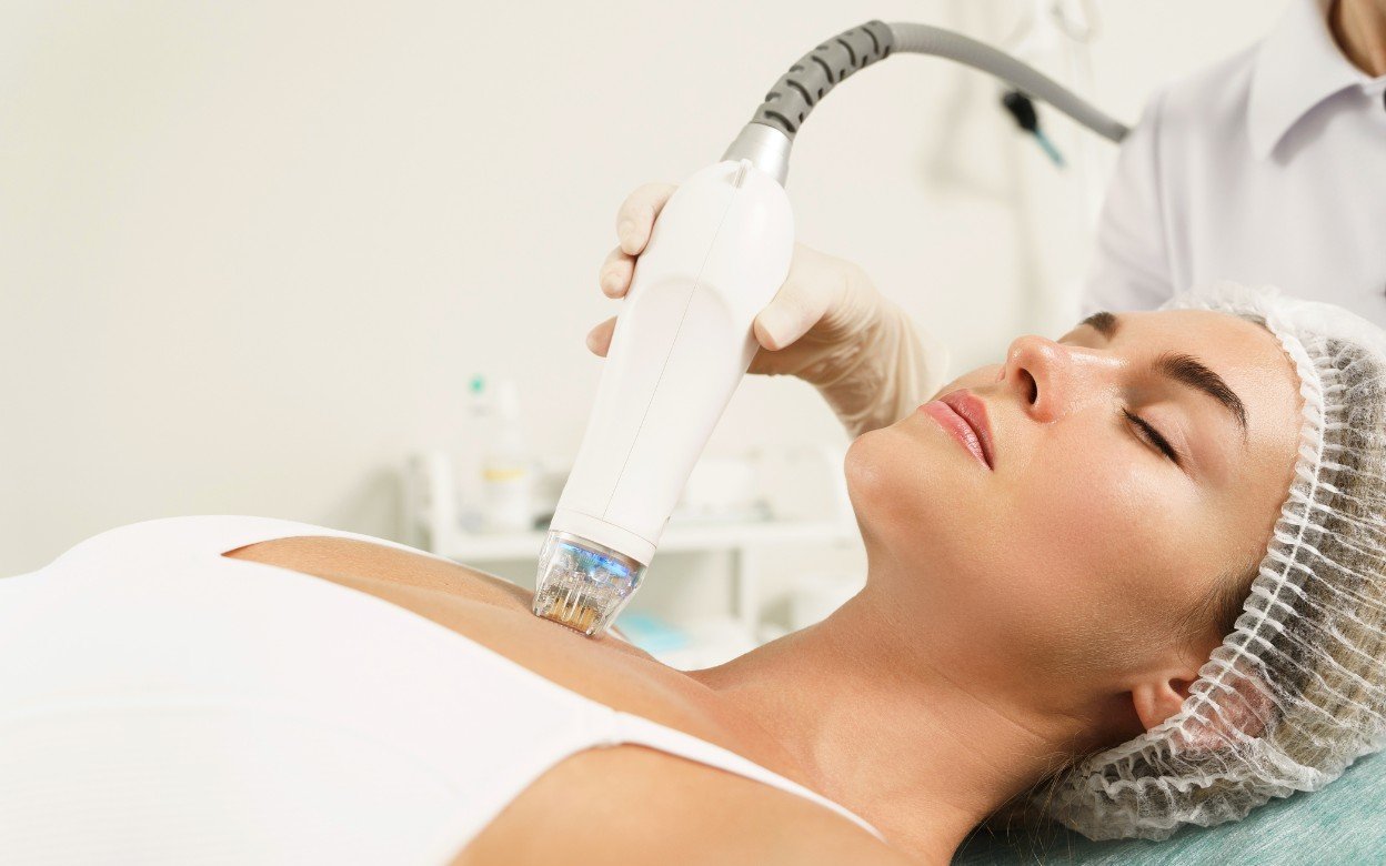 التردد الراديوي