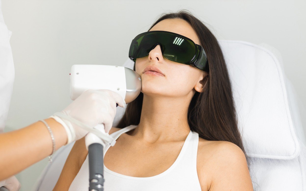 تبييض الشعر بالليزر