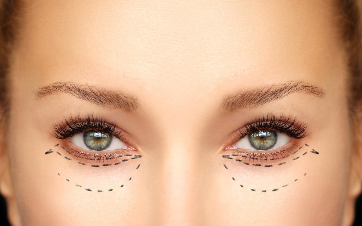 Almond Eye Aesthetics