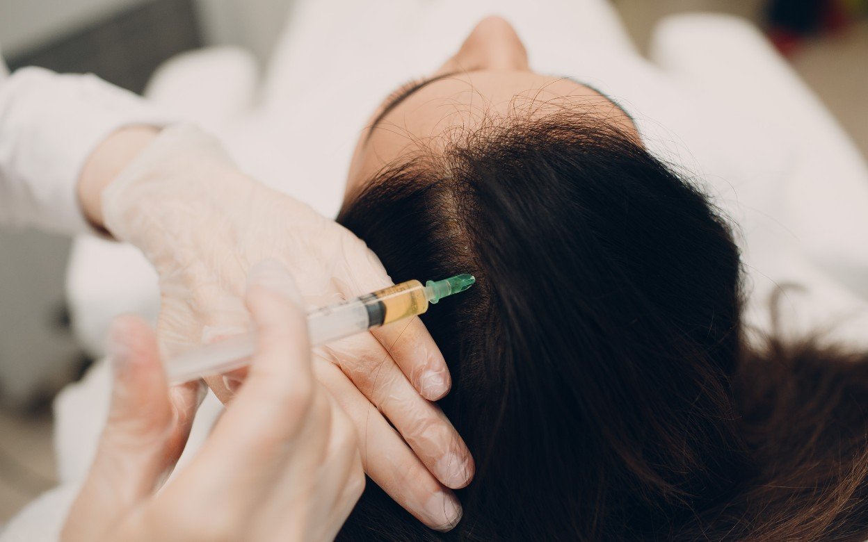 Hair Mesotherapy