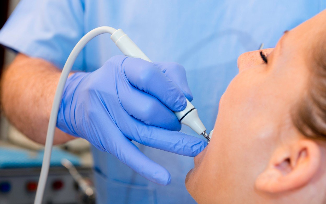 Tooth Stone Cleaning
